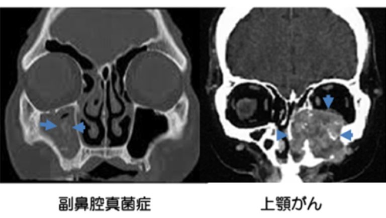 リトグリ bilibili